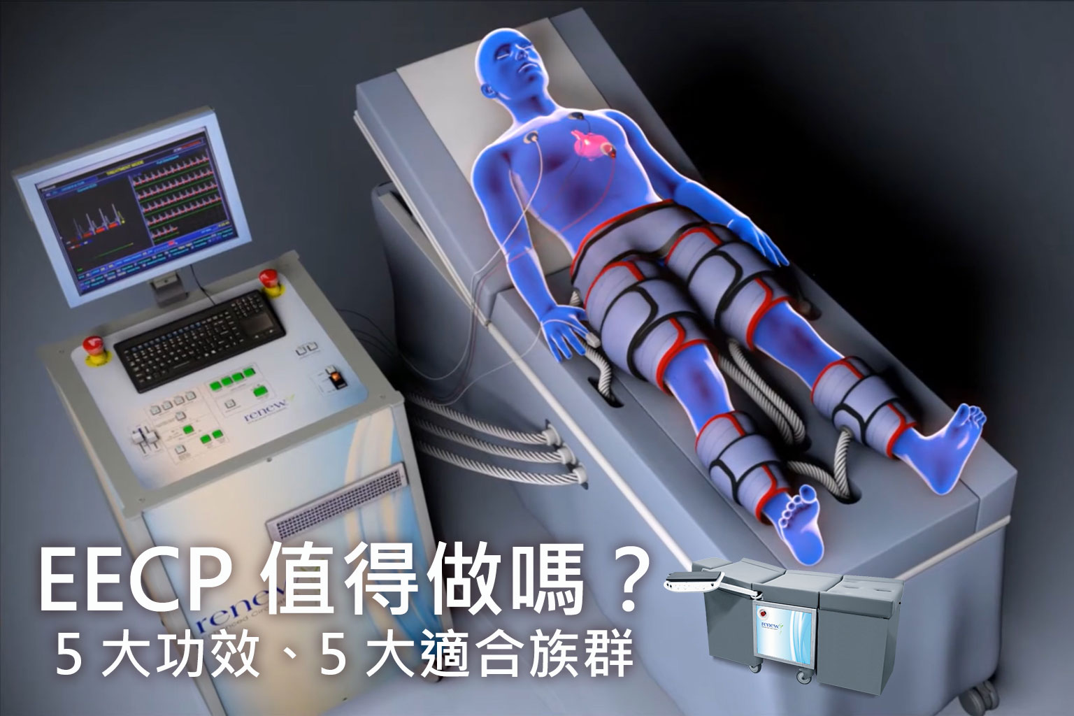 EECP 值得做嗎？5 大功效、5 大適合族群重點分析