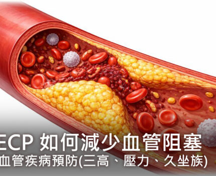 EECP 如何減少血管阻塞：心血管疾病預防 (三高、壓力、久坐族)