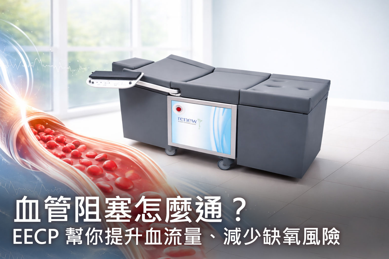 血管阻塞怎麼通？非侵入式 EECP 幫你提升血流量、減少缺氧風險