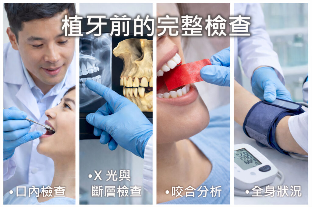 植牙過程 (1)