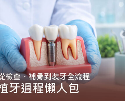 植牙過程懶人包：從檢查、補骨到裝牙全流程