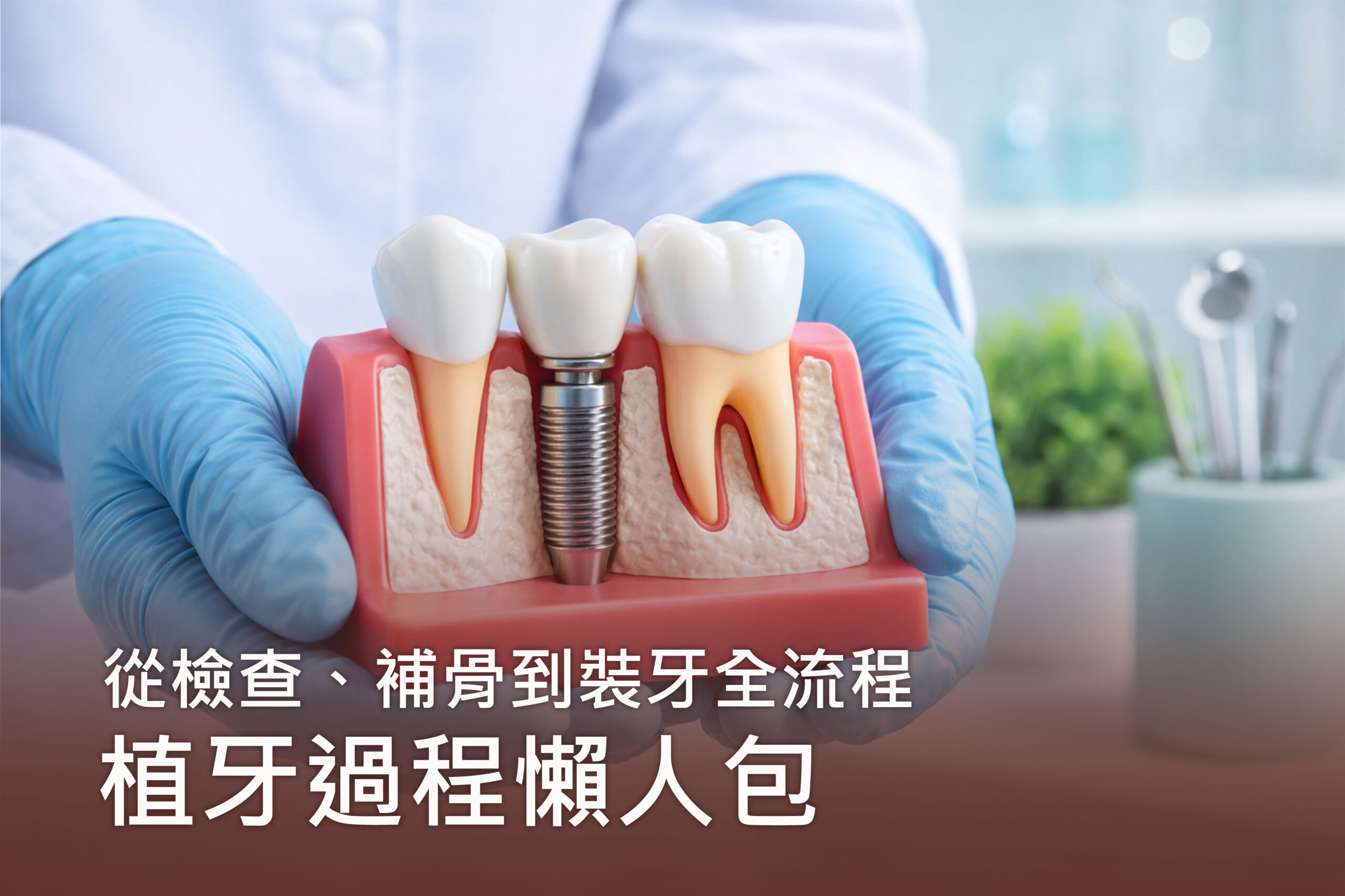 植牙過程懶人包：從檢查、補骨到裝牙全流程