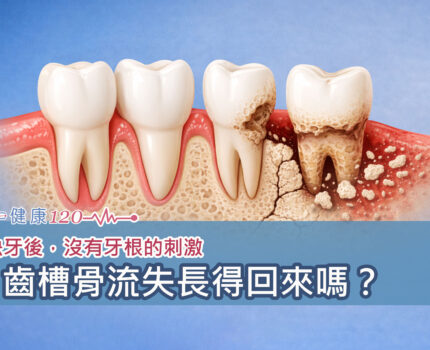 缺牙後，沒有牙根的刺激，齒槽骨流失長得回來嗎？