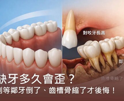 缺牙多久會歪？別等鄰牙倒了、齒槽骨縮了才後悔！