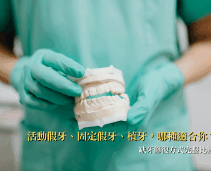 活動假牙、固定假牙、植牙，哪種適合你？缺牙修復方式完整比較